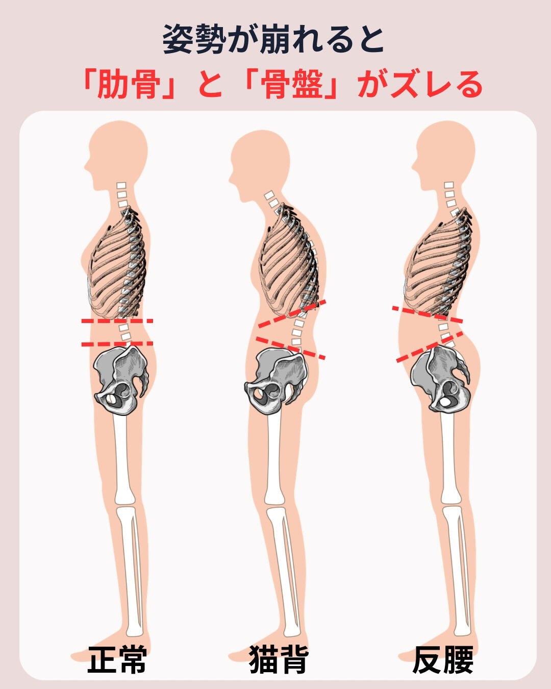 ⭐️稲毛の整体院で姿勢を変えよう⭐️